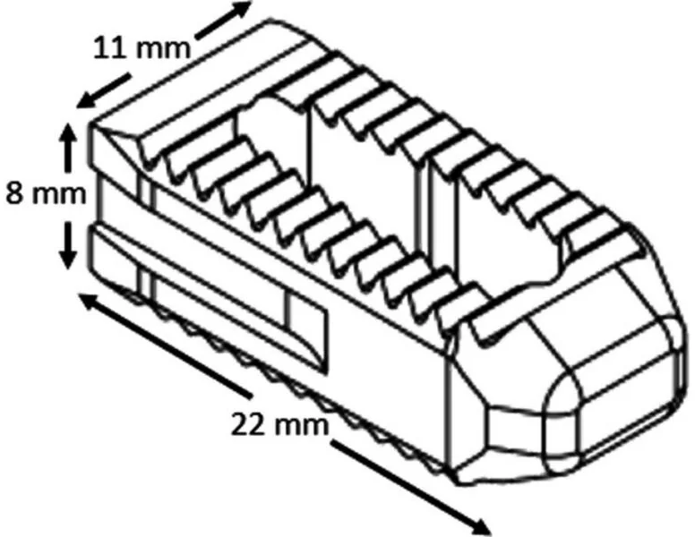 Line drawing of a rectangular bone-graft implant with ridged surfaces, labeled 22 by 11 by 8 millimeters.