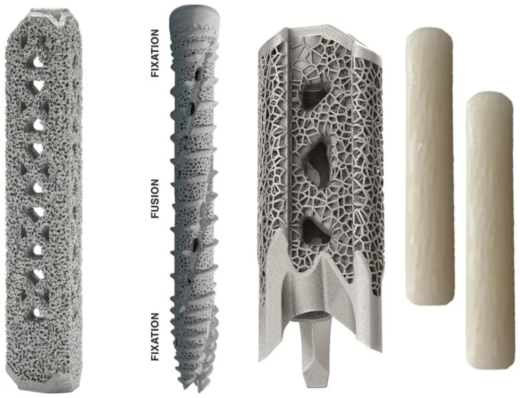 Four SI-BONE implants side by side: a triangular porous titanium rod, a threaded titanium screw, a short titanium lattice implant, and two cylindrical donor-bone dowels.